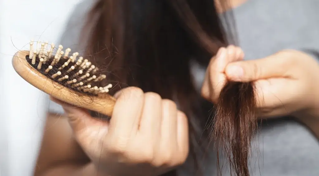 o que é alopecia