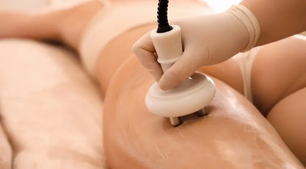 tratamento para celulite